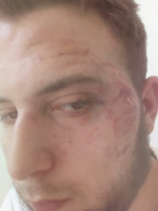В Запорожье избили журналиста: опубликованы фото и реакция сетей